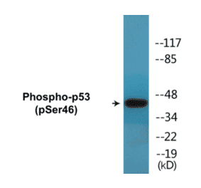 Western Blot - p53 (phospho Ser46) Cell Based ELISA Kit (CBP1646) - Antibodies.com