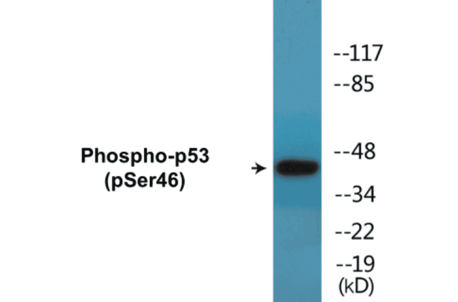 Western Blot - p53 (phospho Ser46) Cell Based ELISA Kit (CBP1646) - Antibodies.com