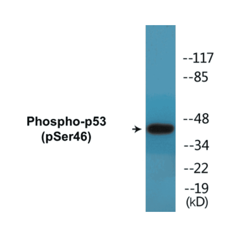 Western Blot - p53 (phospho Ser46) Cell Based ELISA Kit (CBP1646) - Antibodies.com
