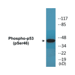 Western Blot - p53 (phospho Ser46) Cell Based ELISA Kit (CBP1646) - Antibodies.com