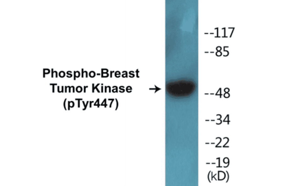 Western Blot - Breast Tumor Kinase (phospho Tyr447) Cell Based ELISA Kit (CBP1298) - Antibodies.com