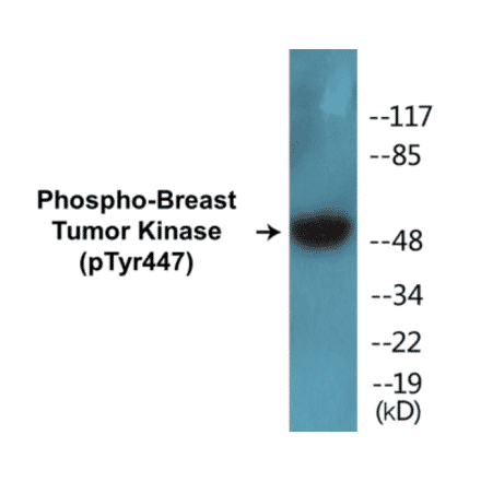 Western Blot - Breast Tumor Kinase (phospho Tyr447) Cell Based ELISA Kit (CBP1298) - Antibodies.com