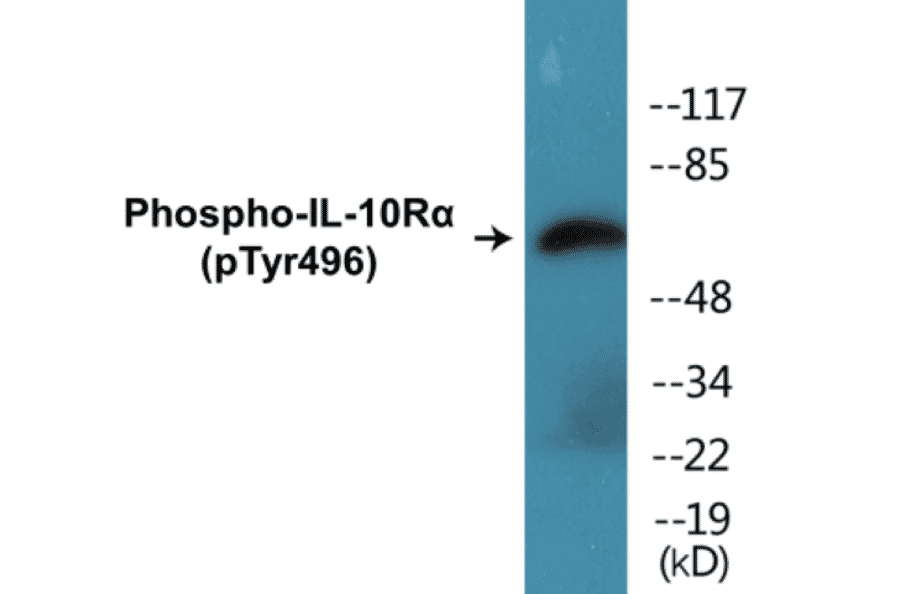 Western Blot - IL-10R alpha (phospho Tyr496) Cell Based ELISA Kit (CBP1415) - Antibodies.com