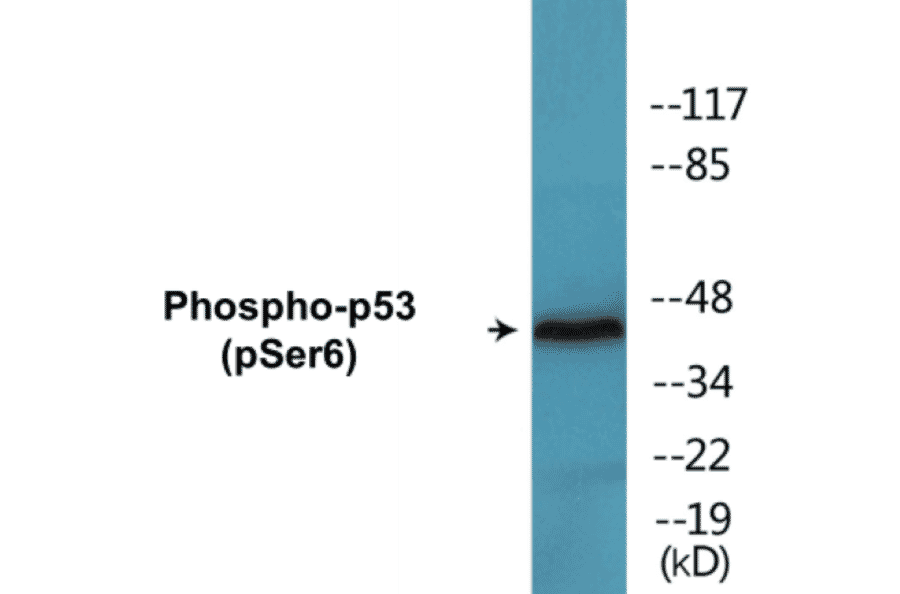 Western Blot - p53 (phospho Ser6) Cell Based ELISA Kit (CBP1647) - Antibodies.com