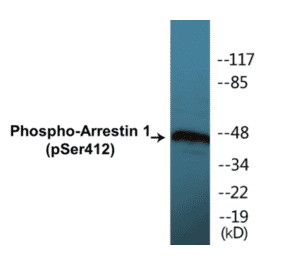 Western Blot - Arrestin 1 (phospho Ser412) Cell Based ELISA Kit (CBP1138) - Antibodies.com