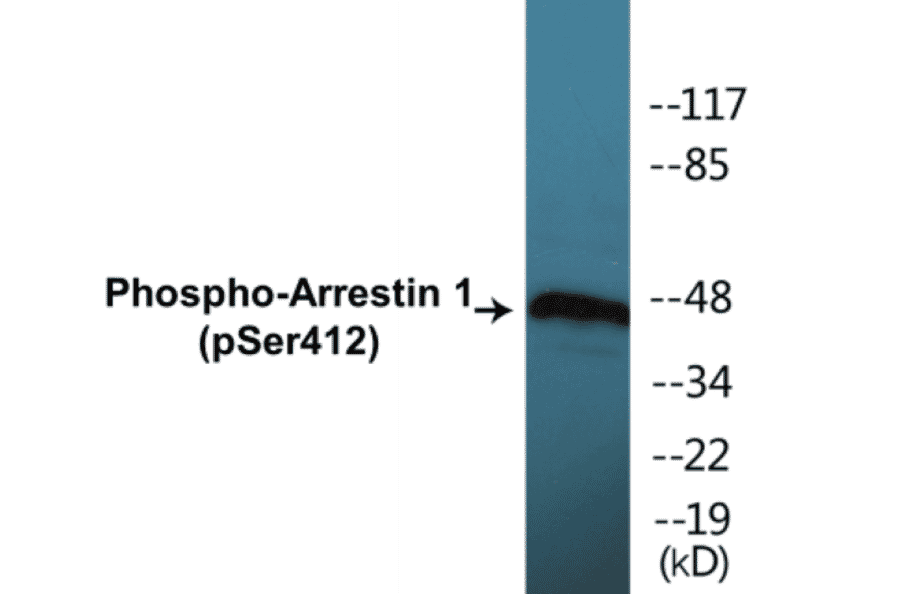 Western Blot - Arrestin 1 (phospho Ser412) Cell Based ELISA Kit (CBP1138) - Antibodies.com