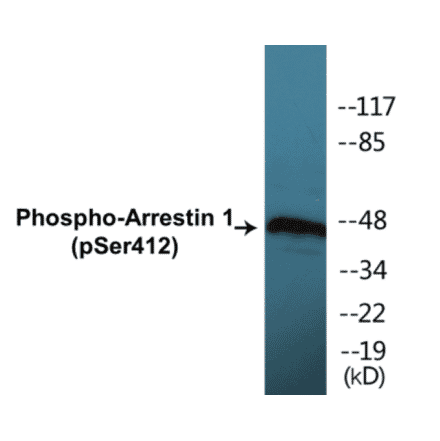 Western Blot - Arrestin 1 (phospho Ser412) Cell Based ELISA Kit (CBP1138) - Antibodies.com