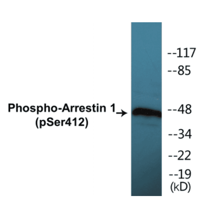 Western Blot - Arrestin 1 (phospho Ser412) Cell Based ELISA Kit (CBP1138) - Antibodies.com