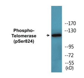 Western Blot - Telomerase (phospho Ser824) Cell Based ELISA Kit (CBP1460) - Antibodies.com