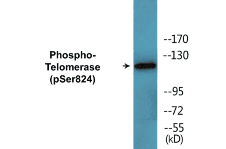 Western Blot - Telomerase (phospho Ser824) Cell Based ELISA Kit (CBP1460) - Antibodies.com