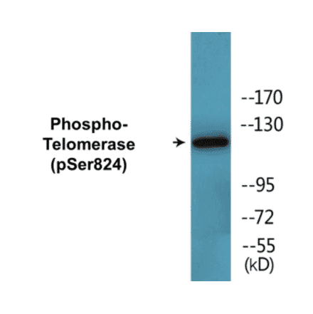Western Blot - Telomerase (phospho Ser824) Cell Based ELISA Kit (CBP1460) - Antibodies.com