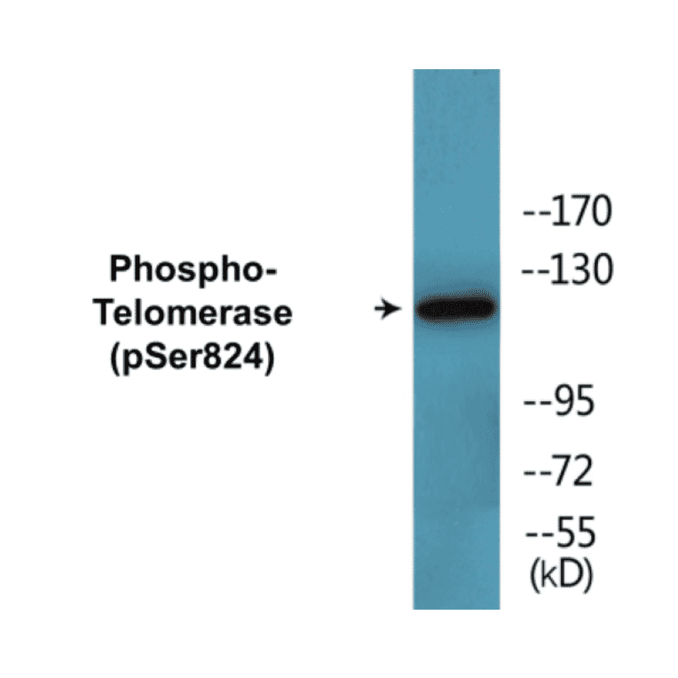 Western Blot - Telomerase (phospho Ser824) Cell Based ELISA Kit (CBP1460) - Antibodies.com