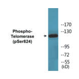 Western Blot - Telomerase (phospho Ser824) Cell Based ELISA Kit (CBP1460) - Antibodies.com