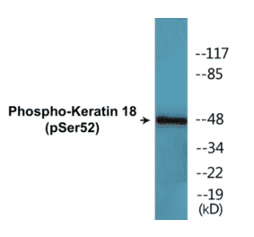 Western Blot - Keratin 18 (phospho Ser52) Cell Based ELISA Kit (CBP1354) - Antibodies.com
