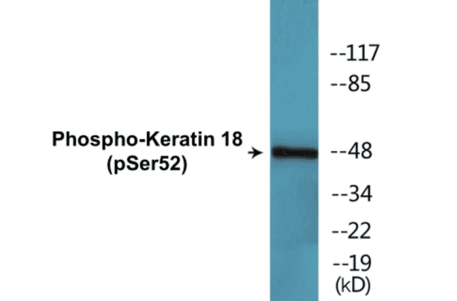 Western Blot - Keratin 18 (phospho Ser52) Cell Based ELISA Kit (CBP1354) - Antibodies.com