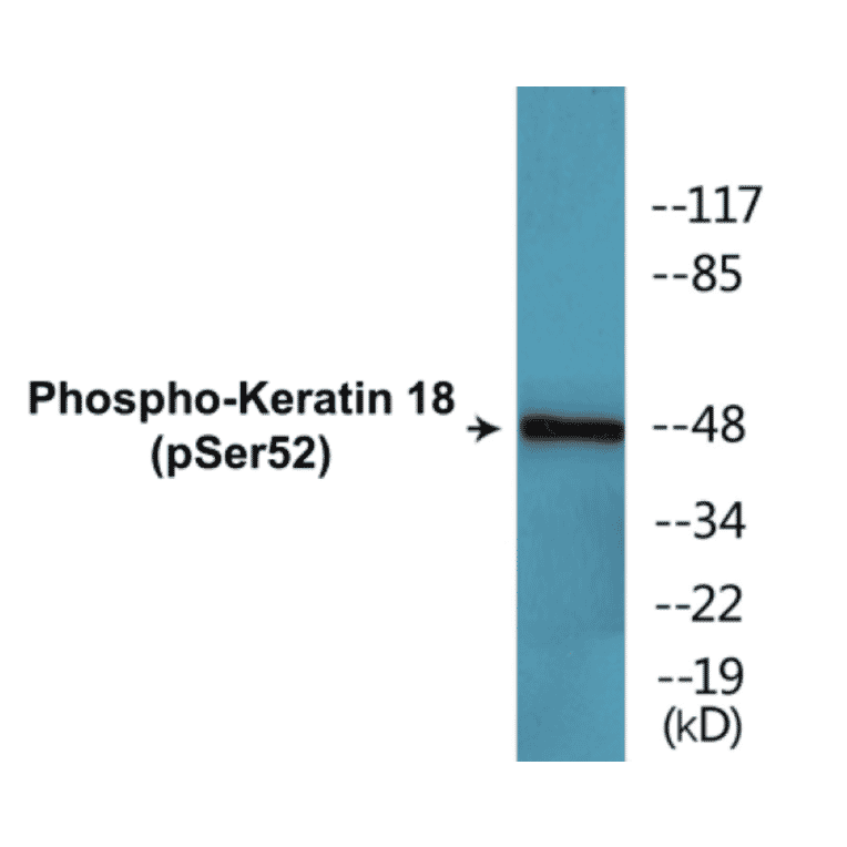 Western Blot - Keratin 18 (phospho Ser52) Cell Based ELISA Kit (CBP1354) - Antibodies.com