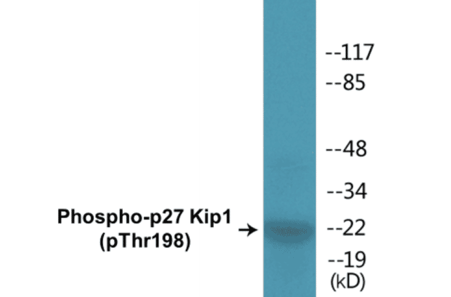 Western Blot - p27 Kip 1 (phospho Thr198) Cell Based ELISA Kit (CBP1385) - Antibodies.com