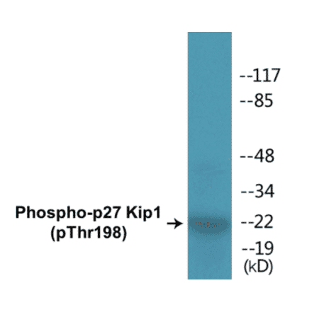 Western Blot - p27 Kip 1 (phospho Thr198) Cell Based ELISA Kit (CBP1385) - Antibodies.com