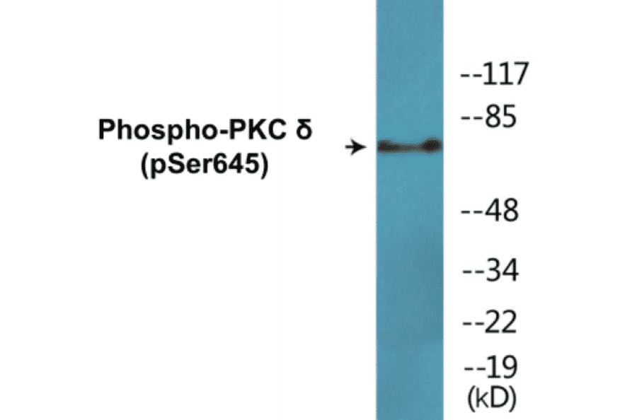 Western Blot - PKC delta (phospho Ser645) Cell Based ELISA Kit (CBP1657) - Antibodies.com