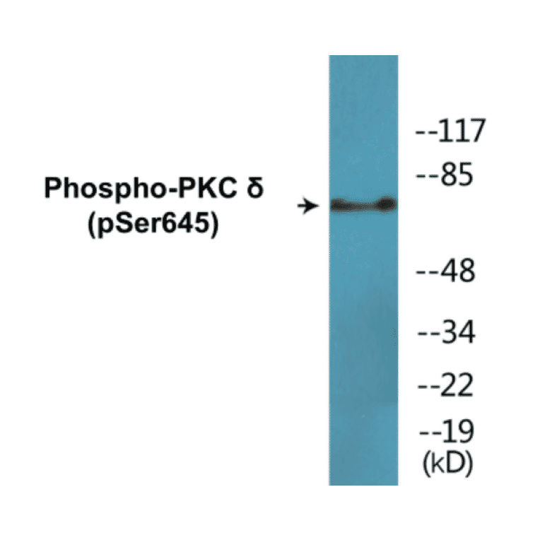 Western Blot - PKC delta (phospho Ser645) Cell Based ELISA Kit (CBP1657) - Antibodies.com