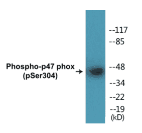 Western Blot - p47 phox (phospho Ser304) Cell Based ELISA Kit (CBP1453) - Antibodies.com