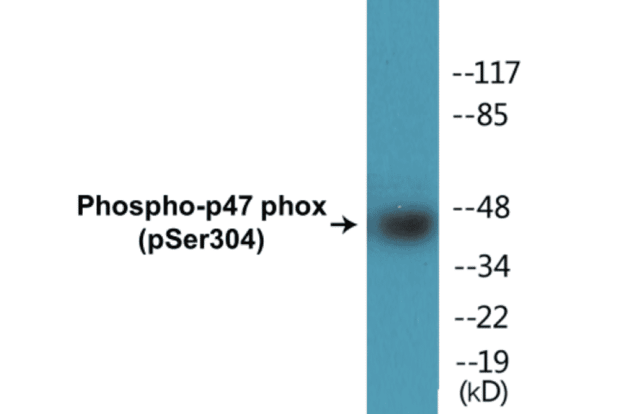 Western Blot - p47 phox (phospho Ser304) Cell Based ELISA Kit (CBP1453) - Antibodies.com