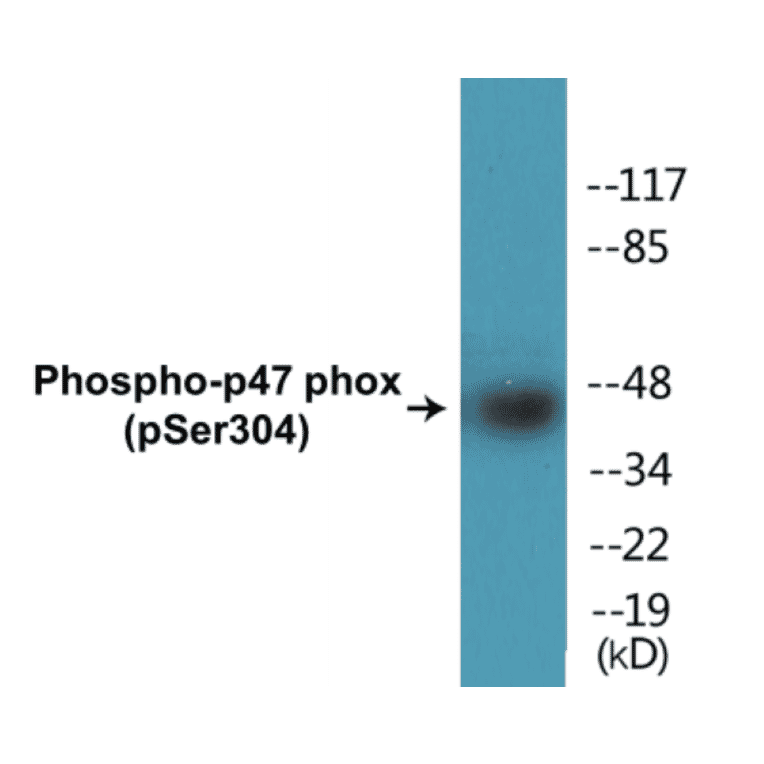 Western Blot - p47 phox (phospho Ser304) Cell Based ELISA Kit (CBP1453) - Antibodies.com