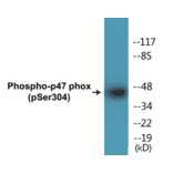 Western Blot - p47 phox (phospho Ser304) Cell Based ELISA Kit (CBP1453) - Antibodies.com