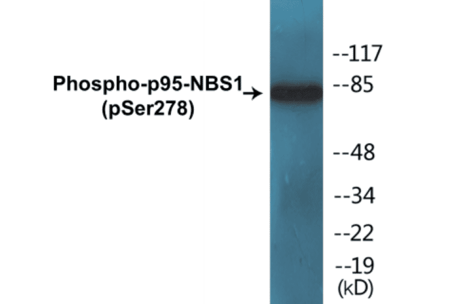 Western Blot - p95-NBS1 (phospho Ser278) Cell Based ELISA Kit (CBP1474) - Antibodies.com