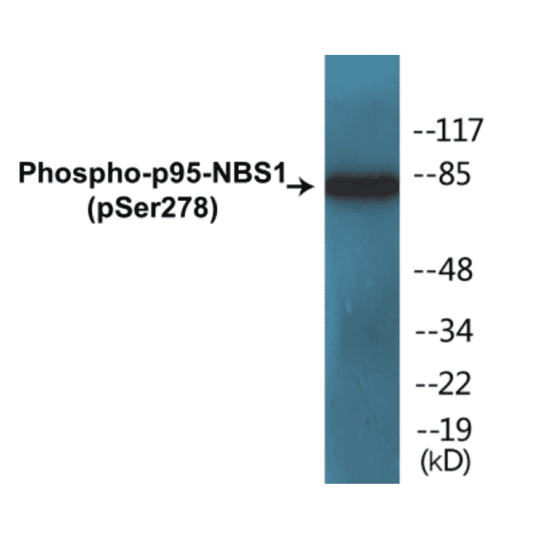 Western Blot - p95-NBS1 (phospho Ser278) Cell Based ELISA Kit (CBP1474) - Antibodies.com