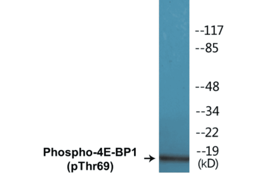 Western Blot - 4E-BP1 (phospho Thr69) Cell Based ELISA Kit (CBP1094) - Antibodies.com