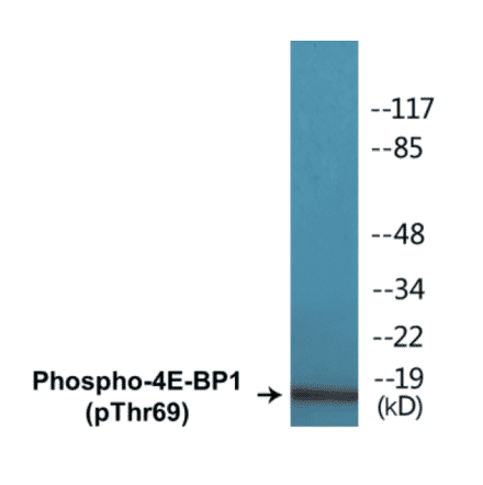 Western Blot - 4E-BP1 (phospho Thr69) Cell Based ELISA Kit (CBP1094) - Antibodies.com