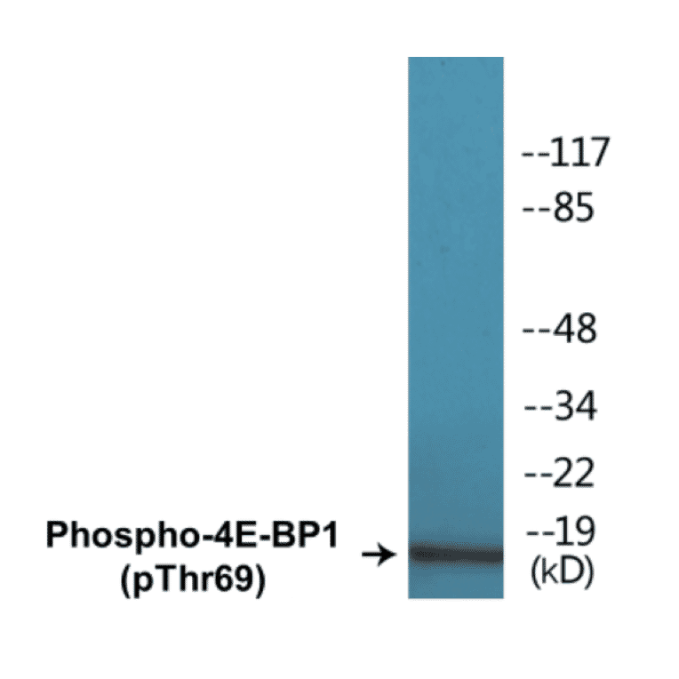 Western Blot - 4E-BP1 (phospho Thr69) Cell Based ELISA Kit (CBP1094) - Antibodies.com