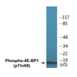 Western Blot - 4E-BP1 (phospho Thr69) Cell Based ELISA Kit (CBP1094) - Antibodies.com