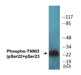 Western Blot - TNNI3 (phospho Ser22 + Ser23) Cell Based ELISA Kit (CBP1225) - Antibodies.com