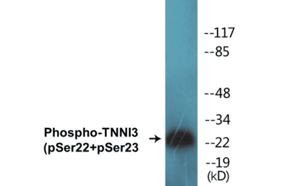 Western Blot - TNNI3 (phospho Ser22 + Ser23) Cell Based ELISA Kit (CBP1225) - Antibodies.com
