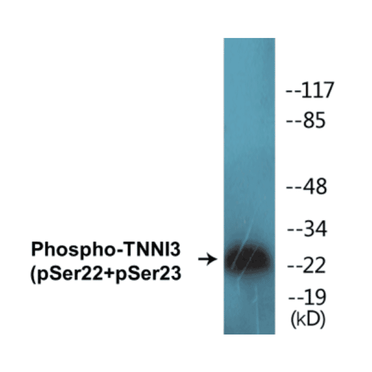 Western Blot - TNNI3 (phospho Ser22 + Ser23) Cell Based ELISA Kit (CBP1225) - Antibodies.com