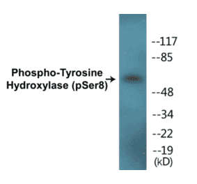 Western Blot - Tyrosine Hydroxylase (phospho Ser8) Cell Based ELISA Kit (CBP1228) - Antibodies.com