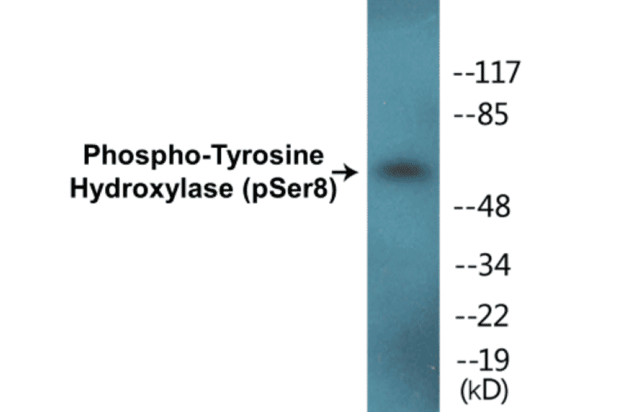 Western Blot - Tyrosine Hydroxylase (phospho Ser8) Cell Based ELISA Kit (CBP1228) - Antibodies.com