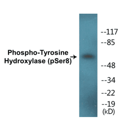 Western Blot - Tyrosine Hydroxylase (phospho Ser8) Cell Based ELISA Kit (CBP1228) - Antibodies.com