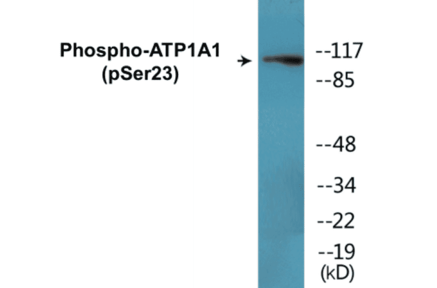 Western Blot - ATP1A1 (phospho Ser23) Cell Based ELISA Kit (CBP1445) - Antibodies.com