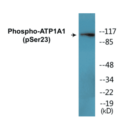 Western Blot - ATP1A1 (phospho Ser23) Cell Based ELISA Kit (CBP1445) - Antibodies.com