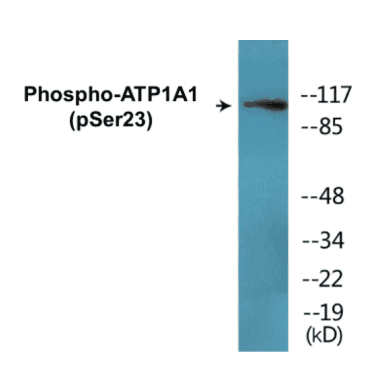 Western Blot - ATP1A1 (phospho Ser23) Cell Based ELISA Kit (CBP1445) - Antibodies.com