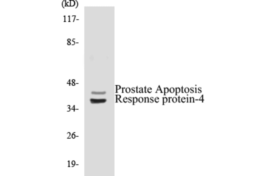 Western Blot - Prostate Apoptosis Response protein 4 Cell Based ELISA Kit (CB5588) - Antibodies.com