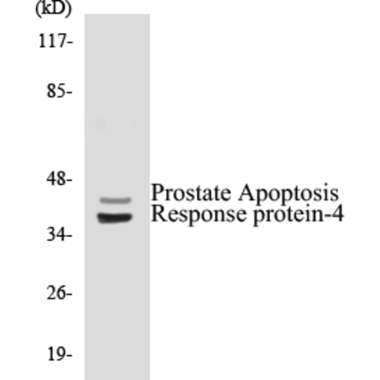 Western Blot - Prostate Apoptosis Response protein 4 Cell Based ELISA Kit (CB5588) - Antibodies.com