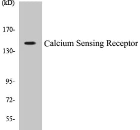 Western Blot - Calcium Sensing Receptor Cell Based ELISA Kit (CB5086) - Antibodies.com