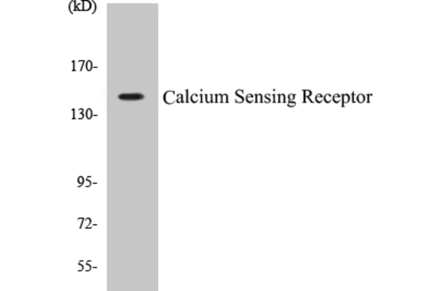 Western Blot - Calcium Sensing Receptor Cell Based ELISA Kit (CB5086) - Antibodies.com