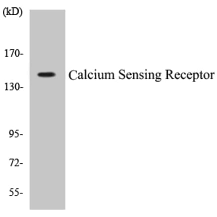 Western Blot - Calcium Sensing Receptor Cell Based ELISA Kit (CB5086) - Antibodies.com