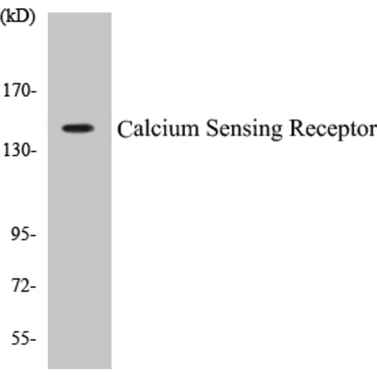Western Blot - Calcium Sensing Receptor Cell Based ELISA Kit (CB5086) - Antibodies.com