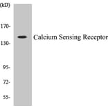 Western Blot - Calcium Sensing Receptor Cell Based ELISA Kit (CB5086) - Antibodies.com